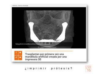 ¿ i m p r i m i r p r ó t e s i s ?
 