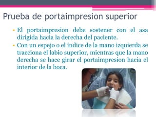 Prueba de portaimpresion superior
• El portaimpresion debe sostener con el asa
dirigida hacia la derecha del paciente.
• Con un espejo o el índice de la mano izquierda se
tracciona el labio superior, mientras que la mano
derecha se hace girar el portaimpresion hacia el
interior de la boca.
 