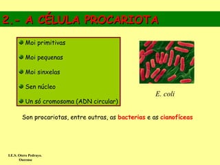 2.- A CÉLULA PROCARIOTA
          Moi primitivas

          Moi pequenas

          Moi sinxelas

          Sen núcleo
                                                      E. coli
          Un só cromosoma (ADN circular)

        Son procariotas, entre outras, as bacterias e as cianofíceas




I.E.S. Otero Pedrayo.
       Ourense
 