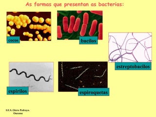 As formas que presentan as bacterias:




  cocos                              bacilos



                                                    estreptobacilos



  espirilos                          espiroquetas


I.E.S. Otero Pedrayo.
       Ourense
 