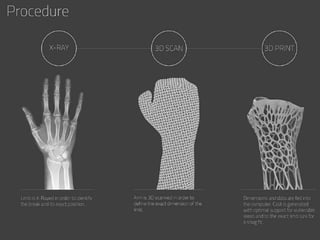 Impresion 3D aplicaciones