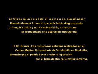 La foto es de un  b e b é de  21  s e m a n a s , aún sin nacer,  llamado  Samuel Armas  al que se le había diagnosticado  una espina bífida y nunca sobreviviría, a menos que  se le practicara una operación intrauterina. El Dr. Bruner, tras numerosos estudios realizados en el  Centro Médico Universitario de Vanderbilt, en Nashville, anunció que él podría llevar a cabo la operación,  con el bebé dentro de la matríz materna. 