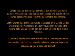 La foto es de un bebé de 21 semanas, aún sin nacer, llamado Samuel Armas al que se le había diagnosticado una espina bífida y nunca sobreviviría si se le extraía de la matriz de su madre. El Dr. Bruner, tras grandes estudios realizados en el Centro Médico Universitario de Vanderbilt, en Nashville, anunció que él podria llevar a cabo una operación así, con el bebé dentro de la matríz materna. Durante la intervención, el cirujano extrae el útero mediante una sección-C y practica una pequeña incisión a través de la cual es capaz de operar al pequeño Samuel. 