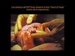 Los editores del NYTimes titularon la foto “Hand of Hope” (mano de la esperanza). 