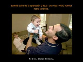 Samuel,  meses después... Samuel salió de la operación y lleva  una vida 100% normal hasta la fecha. 