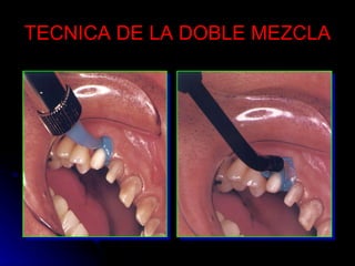 TECNICA DE LA DOBLE MEZCLA 