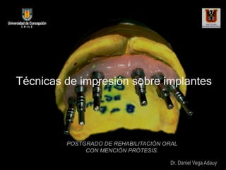 Técnicas de impresión sobre implantes
POSTGRADO DE REHABILITACIÓN ORAL
CON MENCIÓN PRÓTESIS.
Dr. Daniel Vega Adauy
 