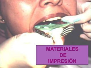 MATERIALES
DE
IMPRESIÓN
 