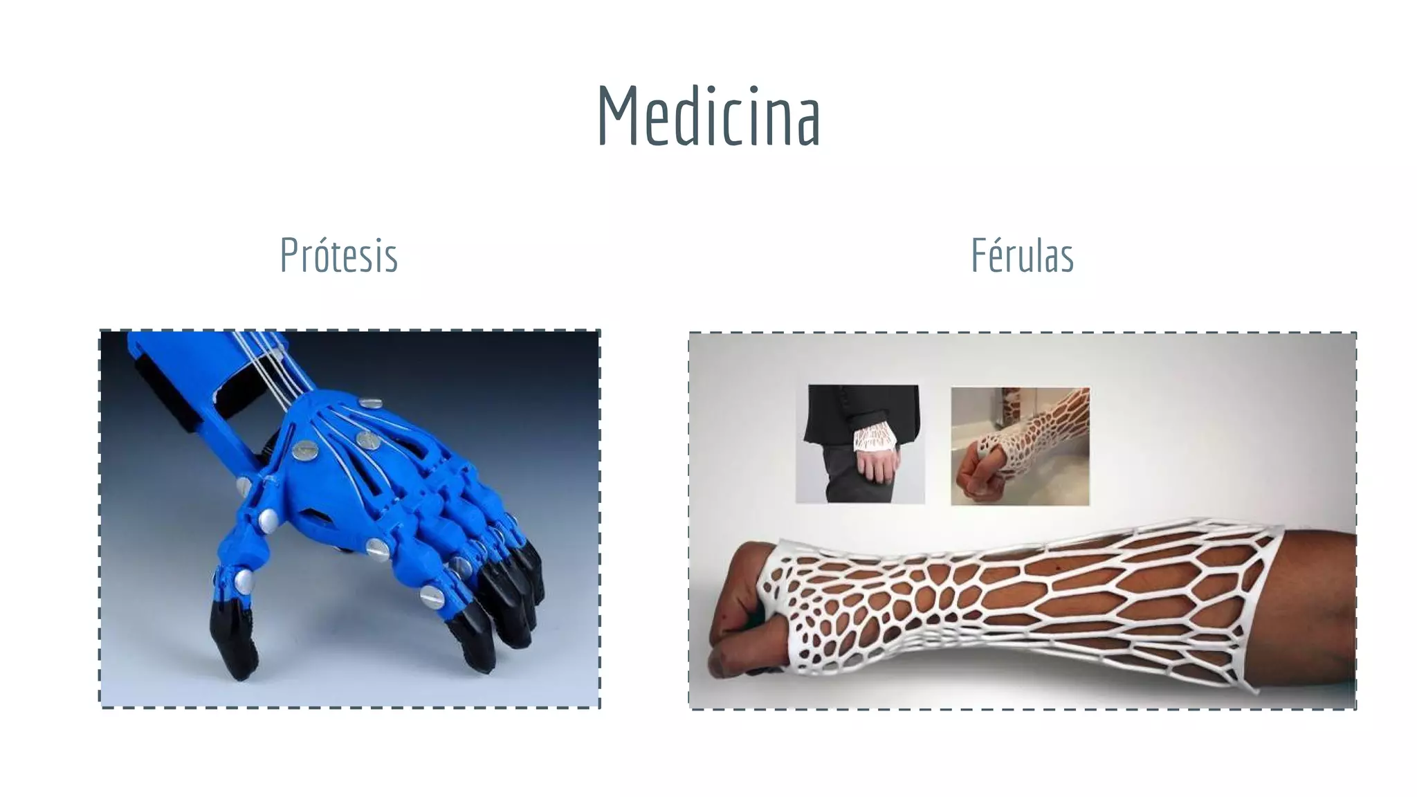 Medicina
Prótesis Férulas
 