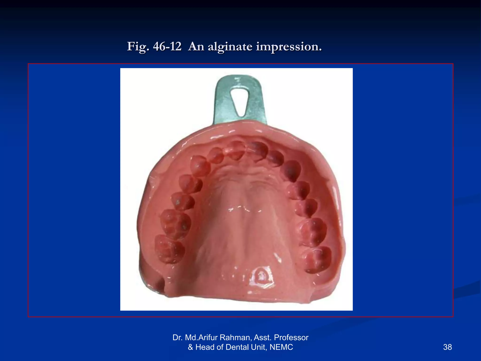 Alginate Impression Techniques With Chromaclone By Ultradent – FNWTXC