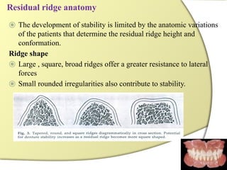 Segmented Ridge Shape Comprehensive Guide to Impressions and Casts in Complete Denture ...