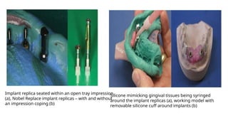 Impression technique-in-implant-dentistry.pptx