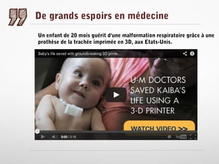 De grands espoirs en médecine
Un enfant de 20 mois guérit d'une malformation respiratoire grâce à une
prothèse de la trachée imprimée en 3D, aux Etats-Unis.

 