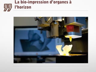 La bio-impression d’organes à
l’horizon

 