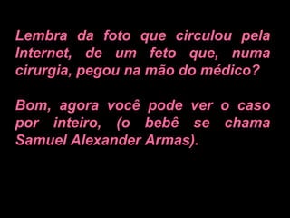 Lembra da foto que circulou pela Internet, de um feto que, numa cirurgia, pegou na mão do médico?  Bom, agora você pode ver o caso por inteiro, (o bebê se chama Samuel Alexander Armas).   