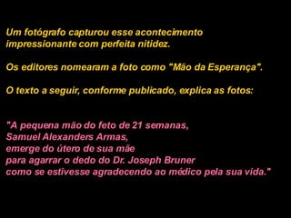 Um fotógrafo capturou esse acontecimento impressionante com perfeita nitidez.  Os editores nomearam a foto como "Mão da Esperança".  O texto a seguir, conforme publicado, explica as fotos:   "A pequena mão do feto de 21 semanas,  Samuel Alexanders Armas,  emerge do útero de sua mãe  para agarrar o dedo do Dr. Joseph Bruner  como se estivesse agradecendo ao médico pela sua vida." 