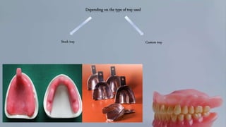 Impression in Complete Denture | PPTX