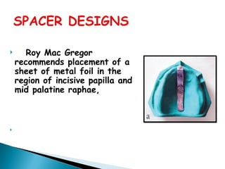  Roy Mac Gregor
recommends placement of a
sheet of metal foil in the
region of incisive papilla and
mid palatine raphae,

 