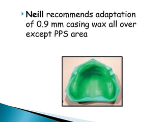  Neill recommends adaptation
of 0.9 mm casing wax all over
except PPS area
 