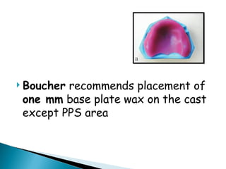  Boucher recommends placement of
one mm base plate wax on the cast
except PPS area
 