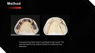 impression in distal extension rpd.pptx presentation seminar | PPTX