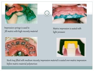 Fixed Impression IMPRESSION MAKING IN FIXED PARTIAL DENTURE.pptx
