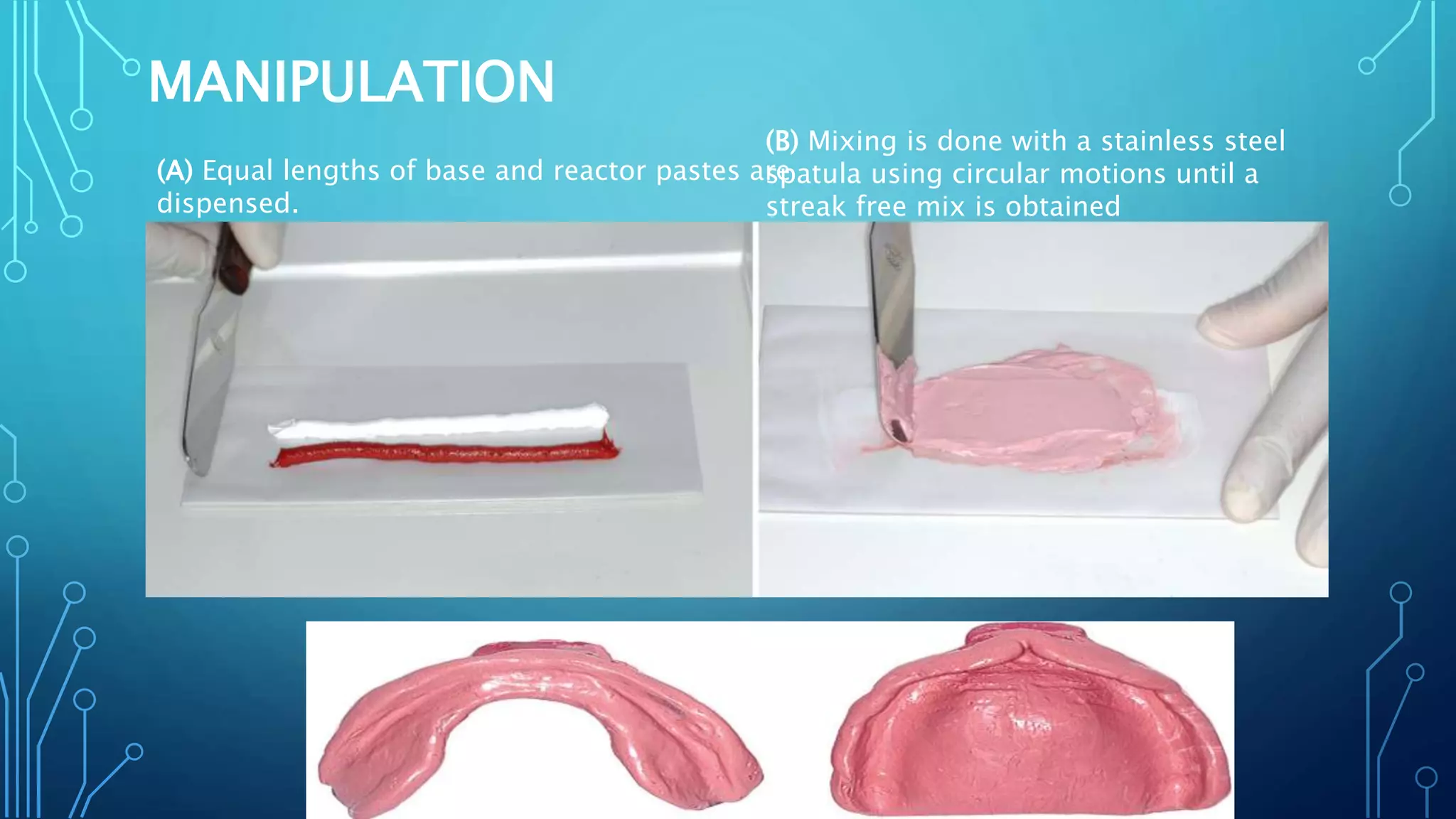 MANIPULATION
(A) Equal lengths of base and reactor pastes are
dispensed.
(B) Mixing is done with a stainless steel
spatula using circular motions until a
streak free mix is obtained
 