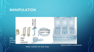MANIPULATION
Hydrocolloid conditioner
Water cooled rim lock trays
Impression
syringes
Connecting
water hose
Agar
tray
material
in tubes
Agar
syringe
materia
l
 
