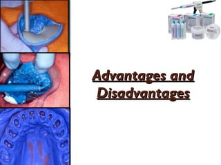 Advantages and
Advantages and
Disadvantages
Disadvantages
 