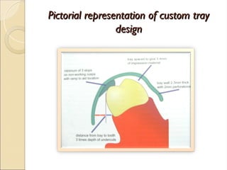 Pictorial representation of custom tray
Pictorial representation of custom tray
design
design
 
