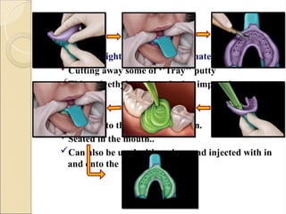 Space for light body ‘’WASH’’ material
Cutting away some of ‘’Tray’’ putty
Thin polyethylene sheet during impression.
 Light body
Placed into the putty impression.
Seated in the mouth..
Can also be used with syringe and injected with in
and onto the preparations.
 