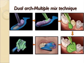 Dual arch-Multiple mix technique
Dual arch-Multiple mix technique
 
