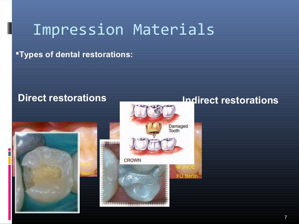 Impression materials 1