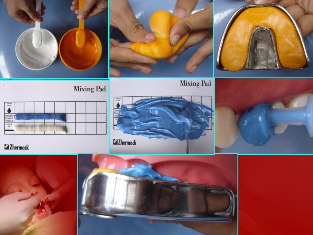 Impression materials and techniques