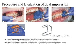 Impression materials and techniques in fpd part 2 | PPTX