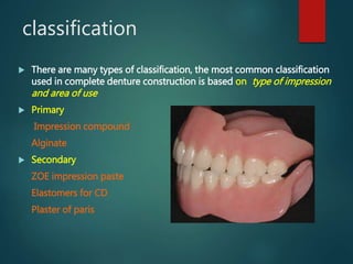 Impression materials for complete denture | PPT