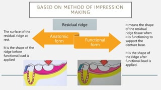 BASED ON METHOD OF IMPRESSION
MAKING
Anatomic
form Functional
form
Residual ridge
The surface of the
residual ridge at
rest.
It is the shape of the
ridge before
functional load is
applied
It means the shape
of the residual
ridge tissue when
it is functioning to
support the
denture base.
It is the shape of
the ridge after
functional load is
applied.
 