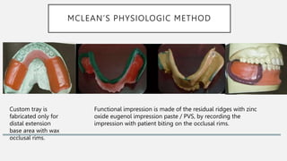 MCLEAN’S PHYSIOLOGIC METHOD
Custom tray is
fabricated only for
distal extension
base area with wax
occlusal rims.
Functional impression is made of the residual ridges with zinc
oxide eugenol impression paste / PVS, by recording the
impression with patient biting on the occlusal rims.
 