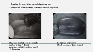 • Tray border smoothed using laboratory bur
• Should be 2mm short of border extension required.
Fluid wax painted onto the intaglio
surface of tray (1-2mm)
Assembly seated in patients mouth
(5-7minutes)
Completed impression
Check for proper tissue contact
 