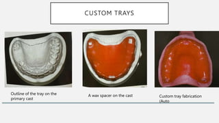 CUSTOM TRAYS
Outline of the tray on the
primary cast
A wax spacer on the cast Custom tray fabrication
(Auto
 