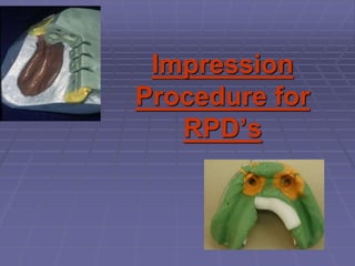 Impression
Procedure for
RPD’s
 