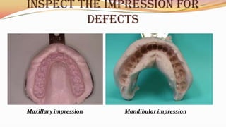 INSPECT THE IMPRESSION FOR
DEFECtS
Mandibular impressionMaxillary impression
 
