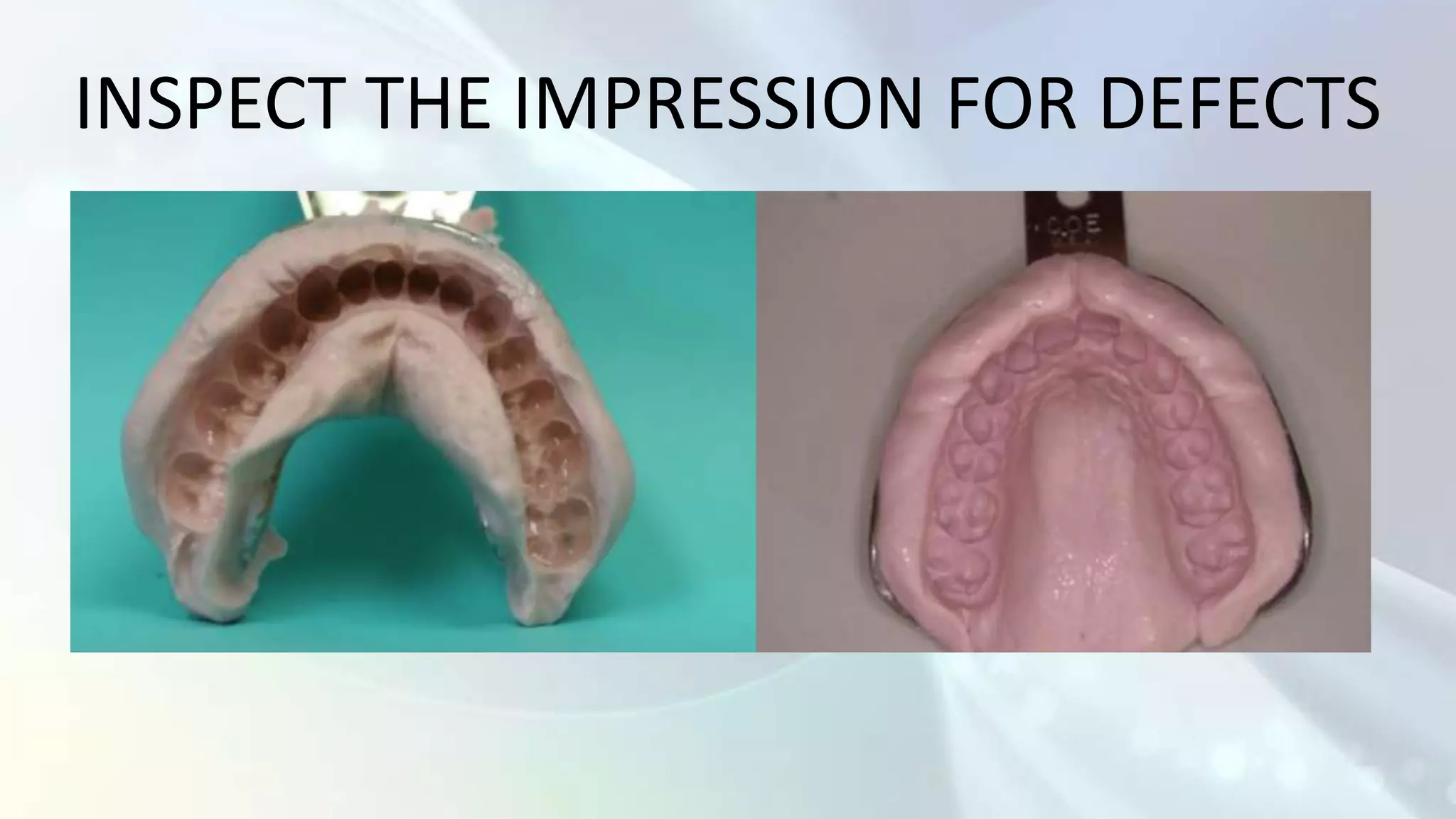 INSPECT THE IMPRESSION FOR DEFECTS
 