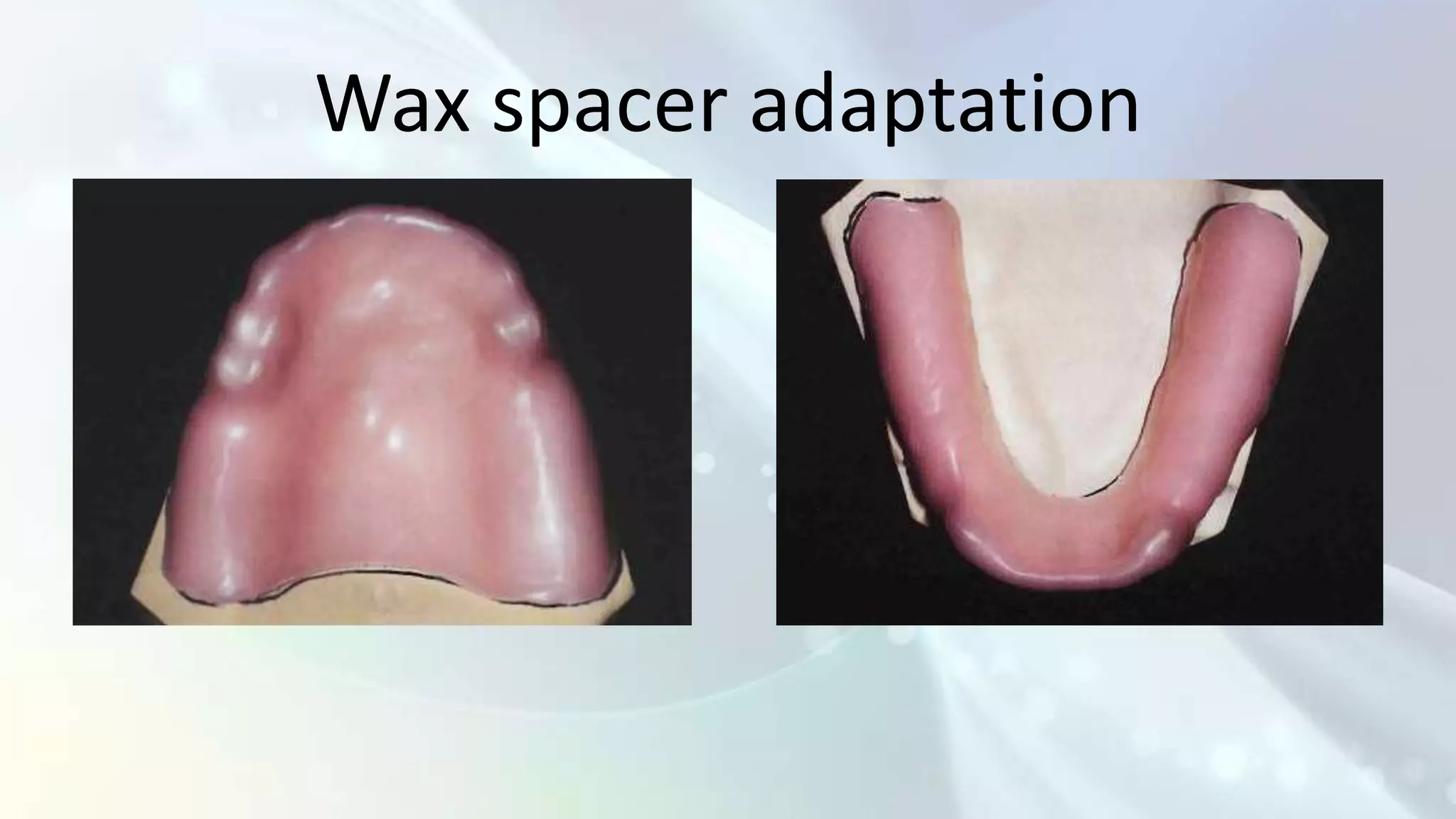Wax spacer adaptation
 