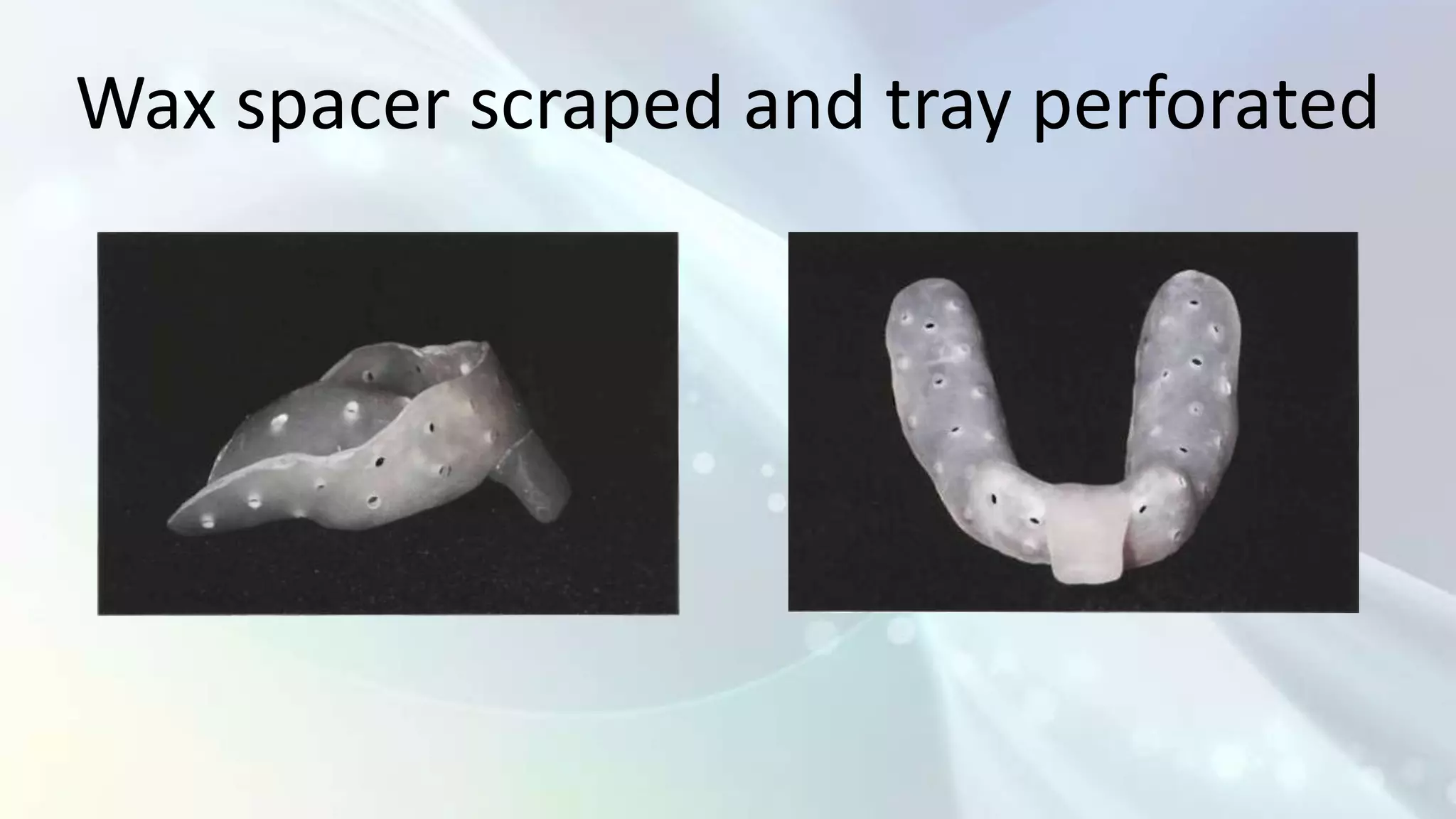 Wax spacer scraped and tray perforated
 