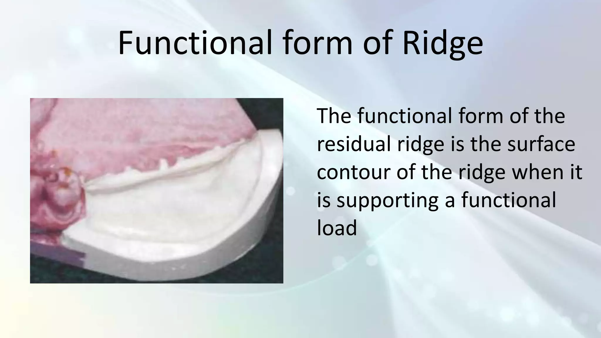 Functional form of Ridge
             The functional form of the
             residual ridge is the surface
             contour of the ridge when it
             is supporting a functional
             load
 