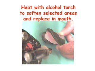 Heat with alcohol torch
to soften selected areas
  and replace in mouth.
 