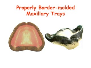Properly Border-molded
    Maxillary Trays
 