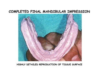 COMPLETED FINAL MANDIBULAR IMPRESSION




   HIGHLY DETAILED REPRODUCTION OF TISSUE SURFACE
 