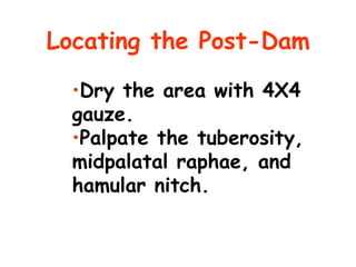 Locating the Post-Dam

  •Dry the area with 4X4
  gauze.
  •Palpate the tuberosity,
  midpalatal raphae, and
  hamular nitch.
 